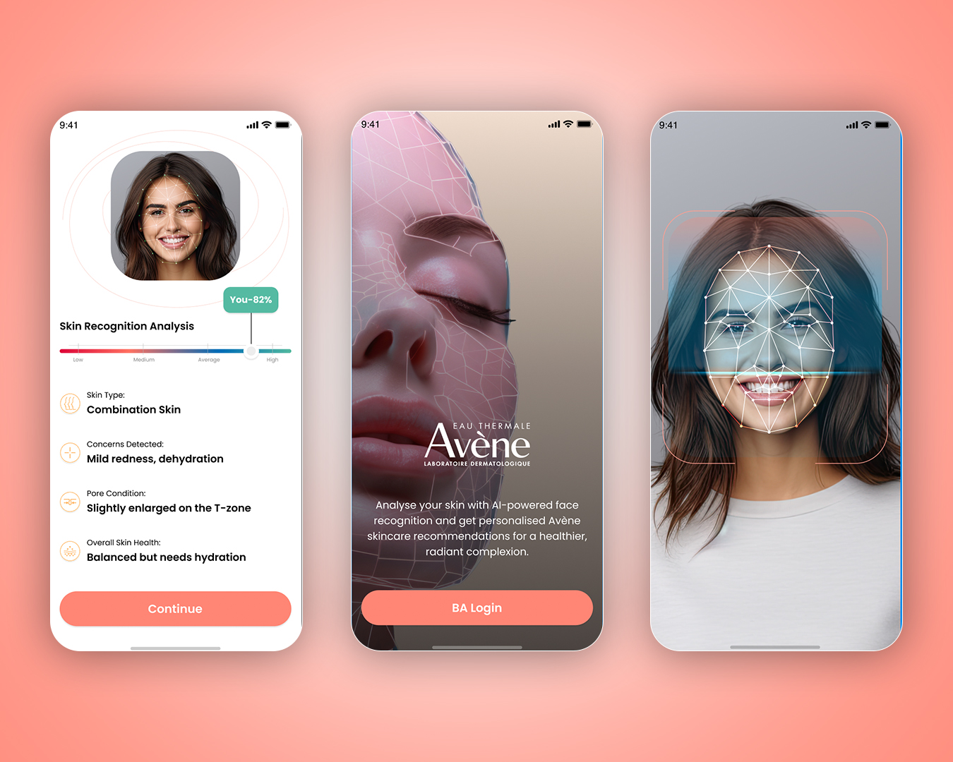 Rapideax portfolio work — showcase 1