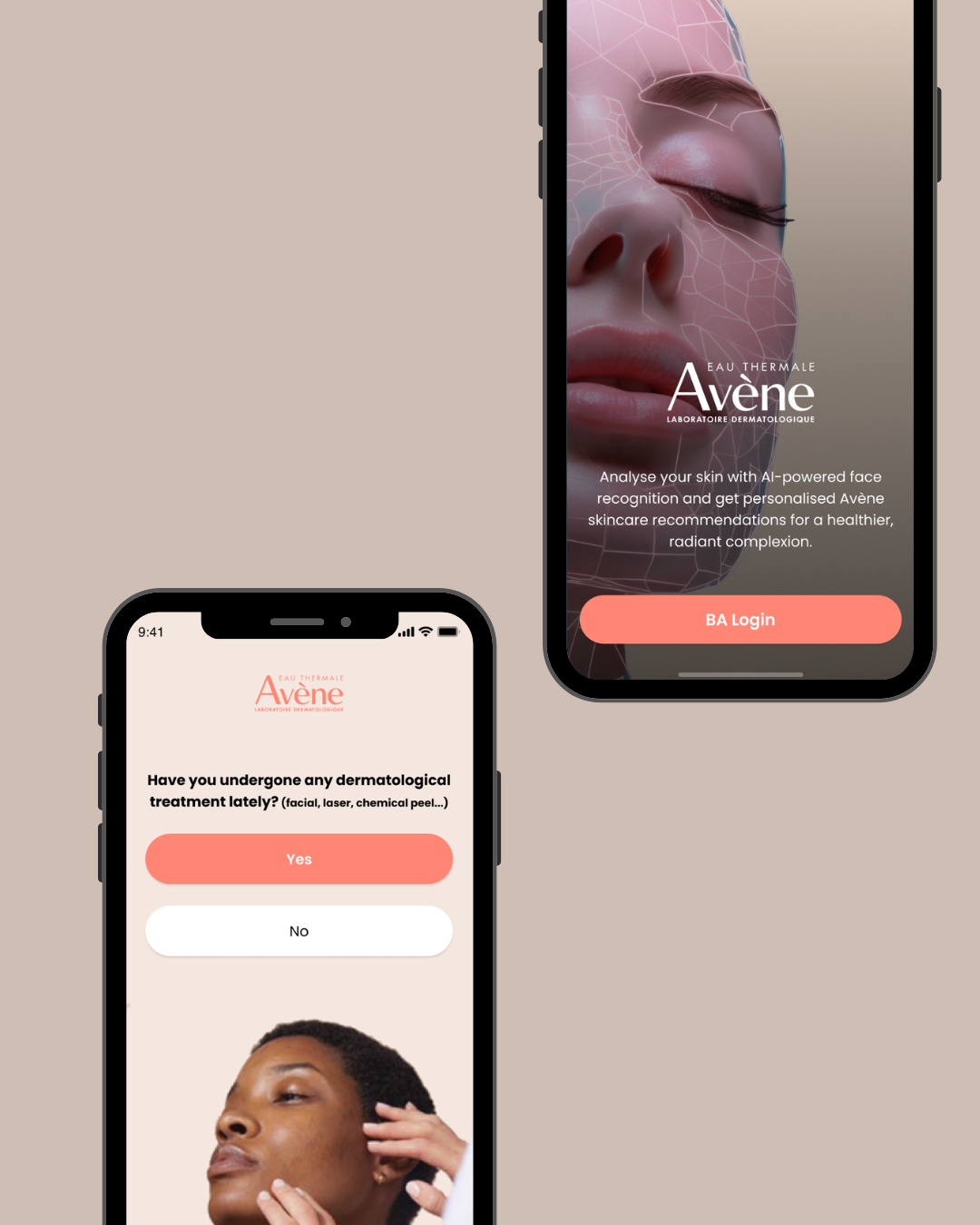 Rapideax portfolio work — showcase 4